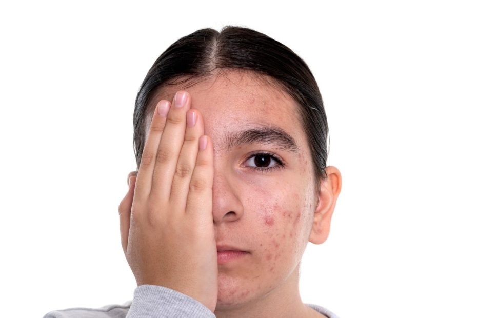 adolescência